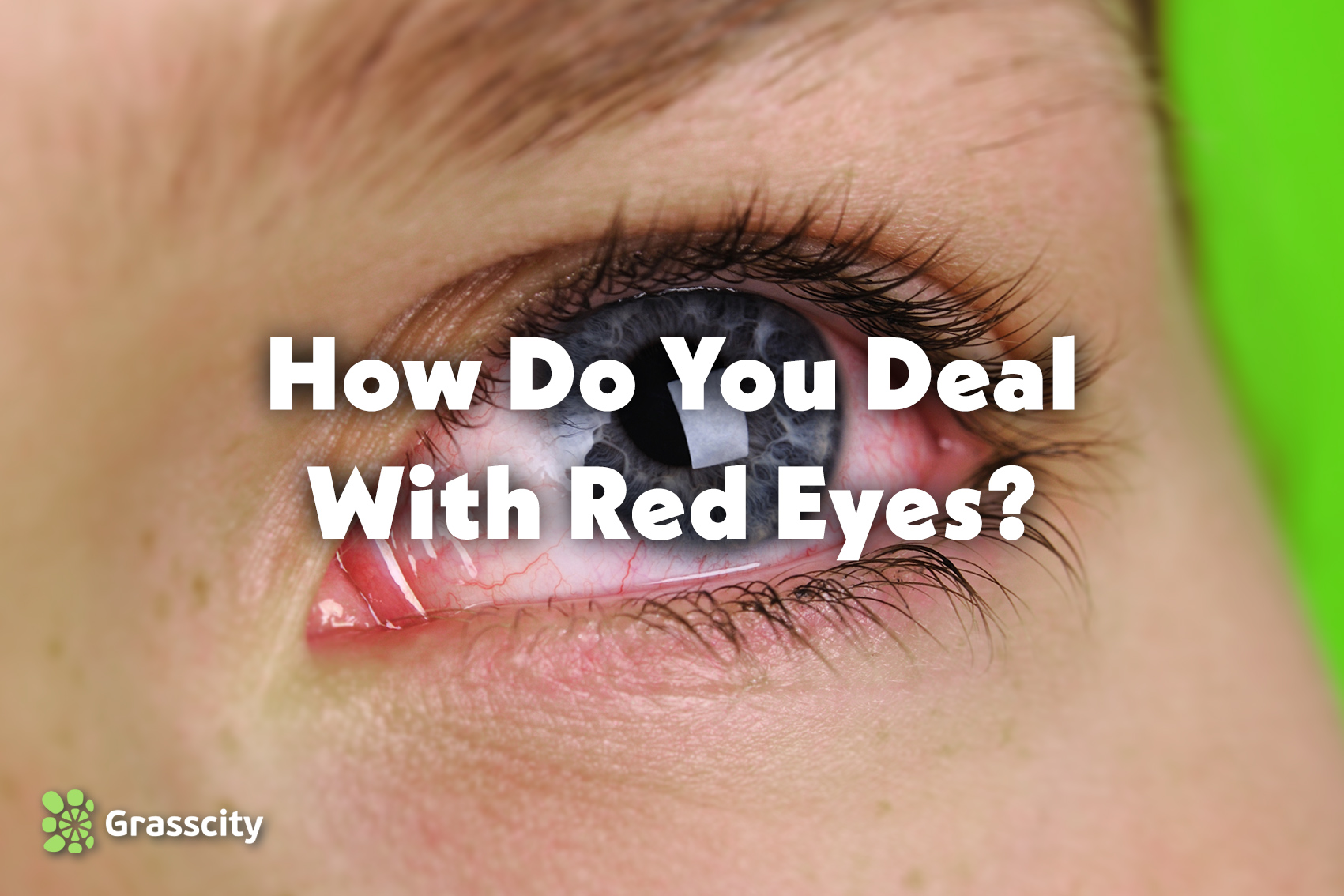 How Do You Deal With Red Eyes?